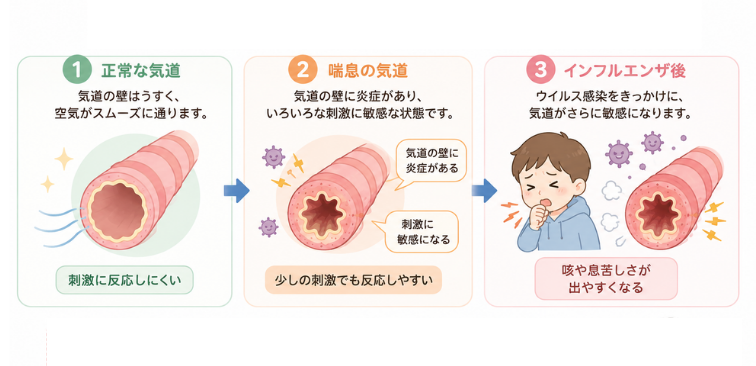 気道の喘息やインフルエンザ症状時の状態の図解